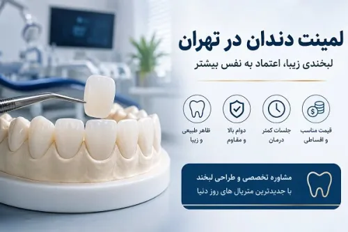 لمینت دندان در تهران